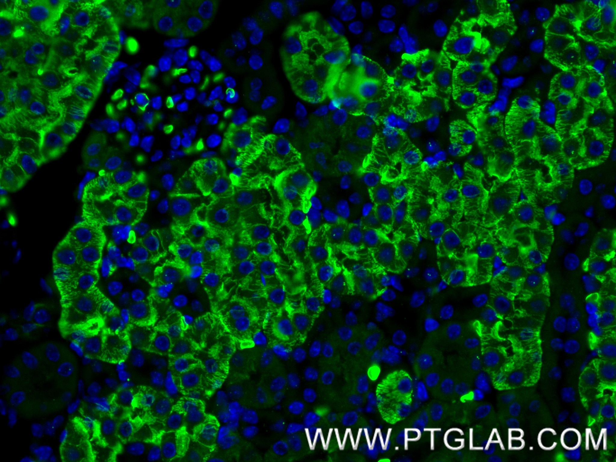 Immunofluorescence (IF) / fluorescent staining of mouse kidney tissue using AQP1 Recombinant monoclonal antibody (81137-2-RR)
