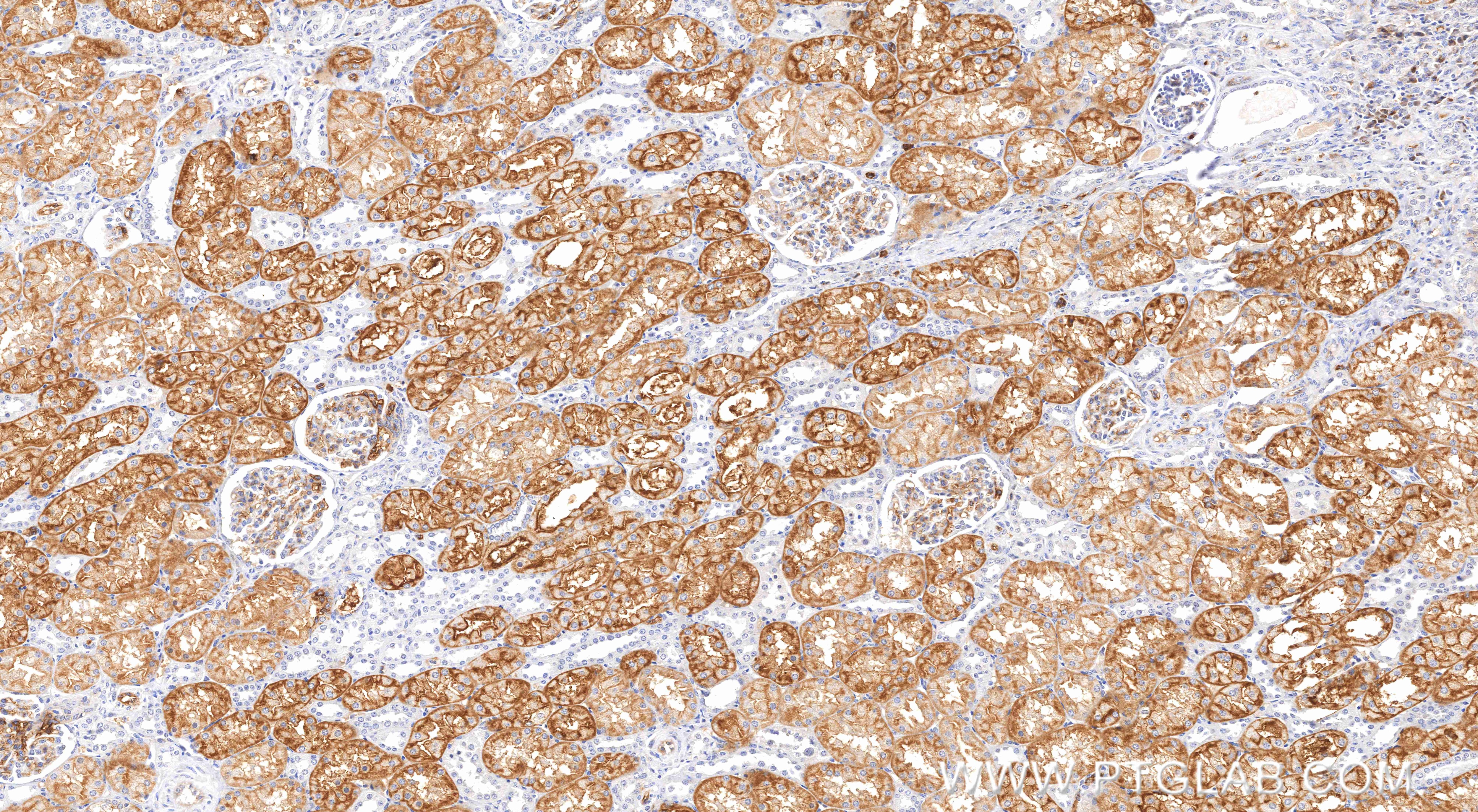 Immunohistochemistry (IHC) staining of human kidney tissue using AQP1 Recombinant monoclonal antibody (81137-2-RR)
