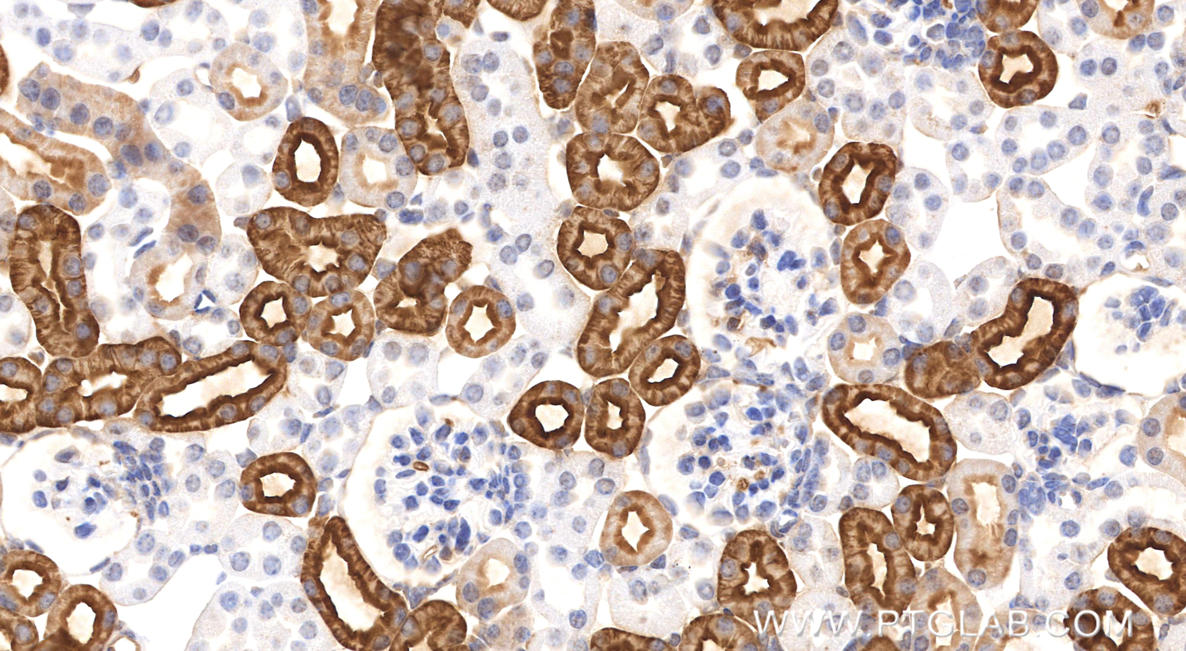 Immunohistochemistry (IHC) staining of mouse kidney tissue using AQP1 Recombinant monoclonal antibody (81137-2-RR)
