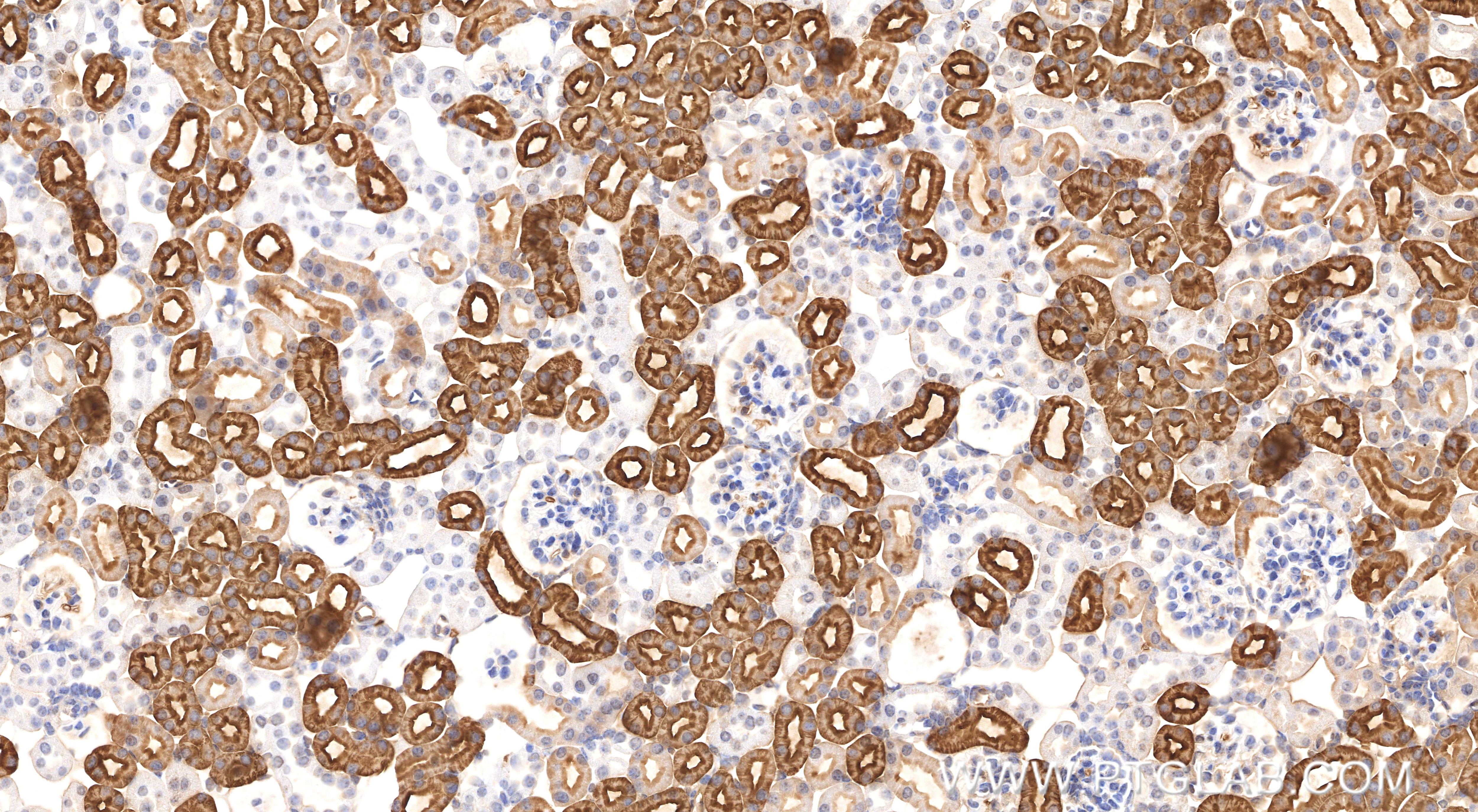 Immunohistochemistry (IHC) staining of mouse kidney tissue using AQP1 Recombinant monoclonal antibody (81137-2-RR)