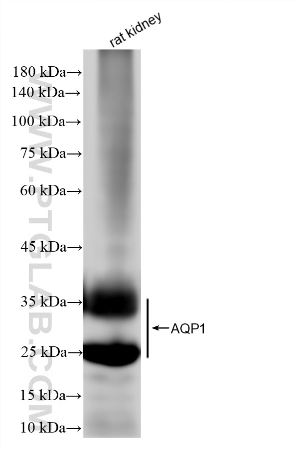 Western Blot (WB) analysis of rat kidney tissue using AQP1 Recombinant monoclonal antibody (81137-2-RR)