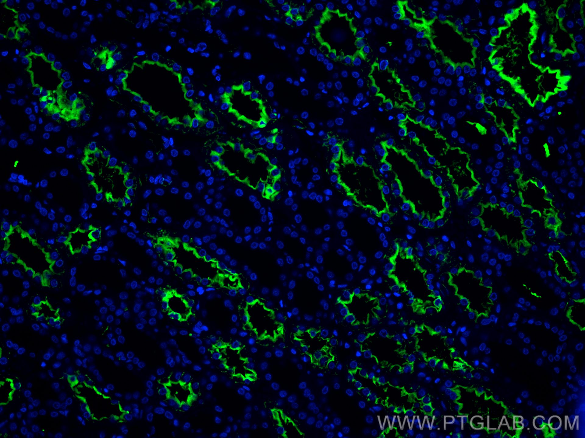 IF Staining of human kidney using CL488-66805