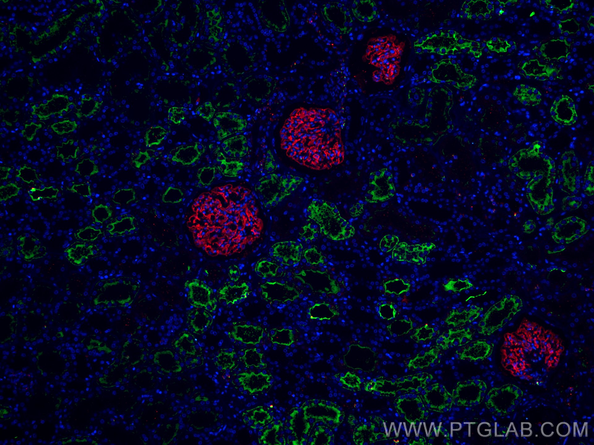 Immunofluorescence (IF) / fluorescent staining of human kidney tissue using CoraLite® Plus 488-conjugated AQP1 Monoclonal anti (CL488-66805)