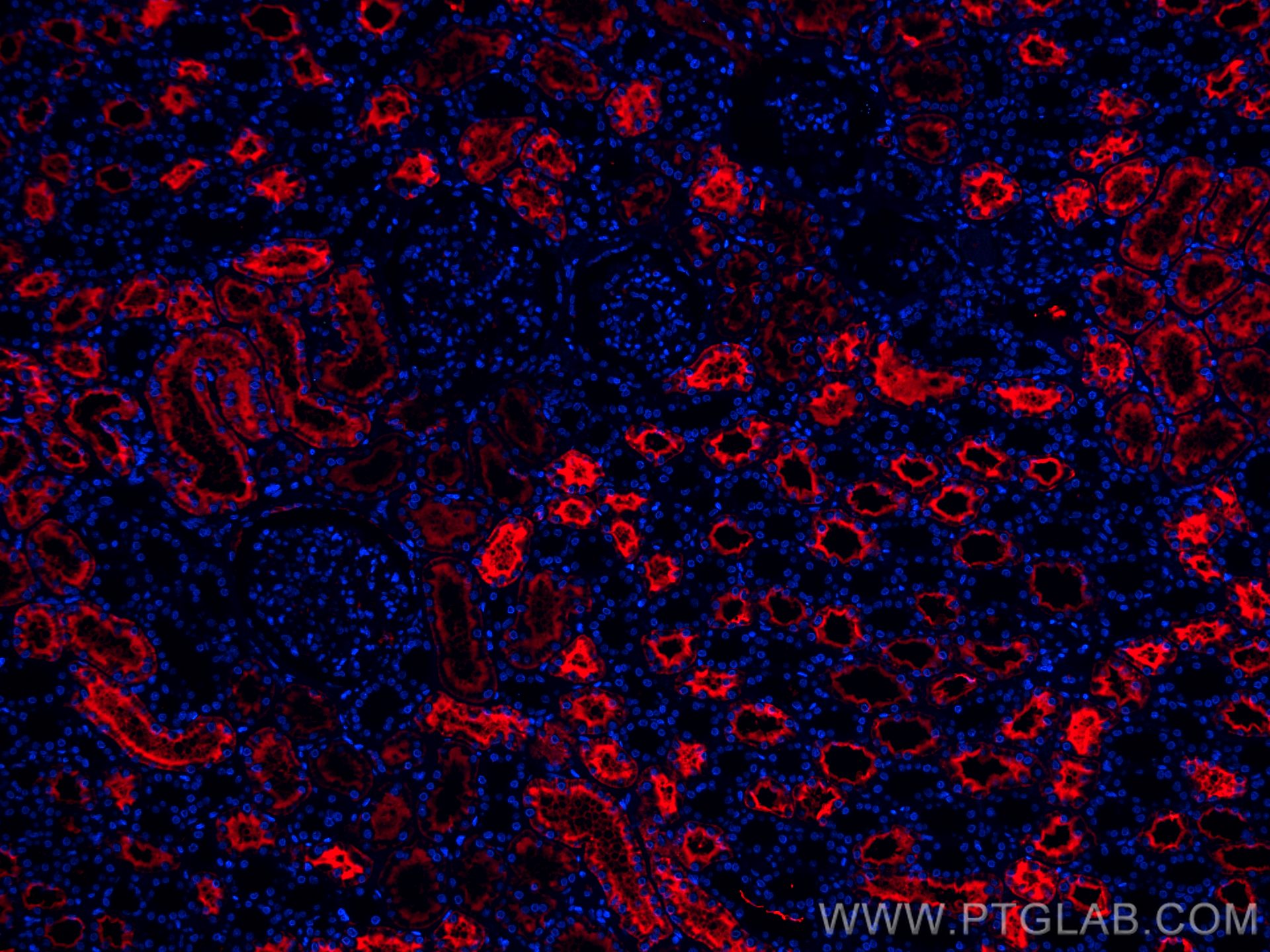 IF Staining of human kidney using CL594-66805