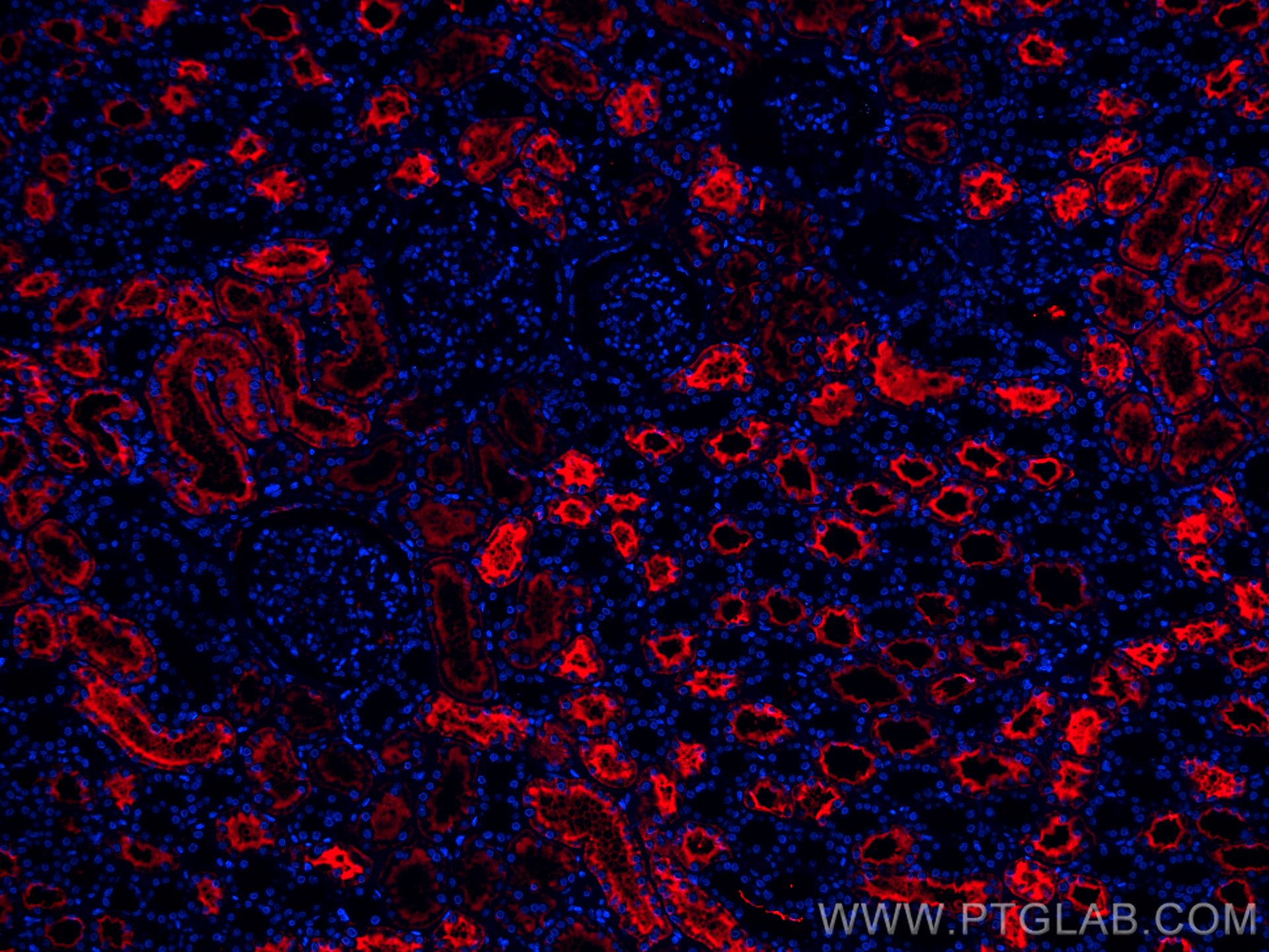 Immunofluorescence (IF) / fluorescent staining of human kidney tissue using CoraLite®594-conjugated AQP1 Monoclonal antibody (CL594-66805)