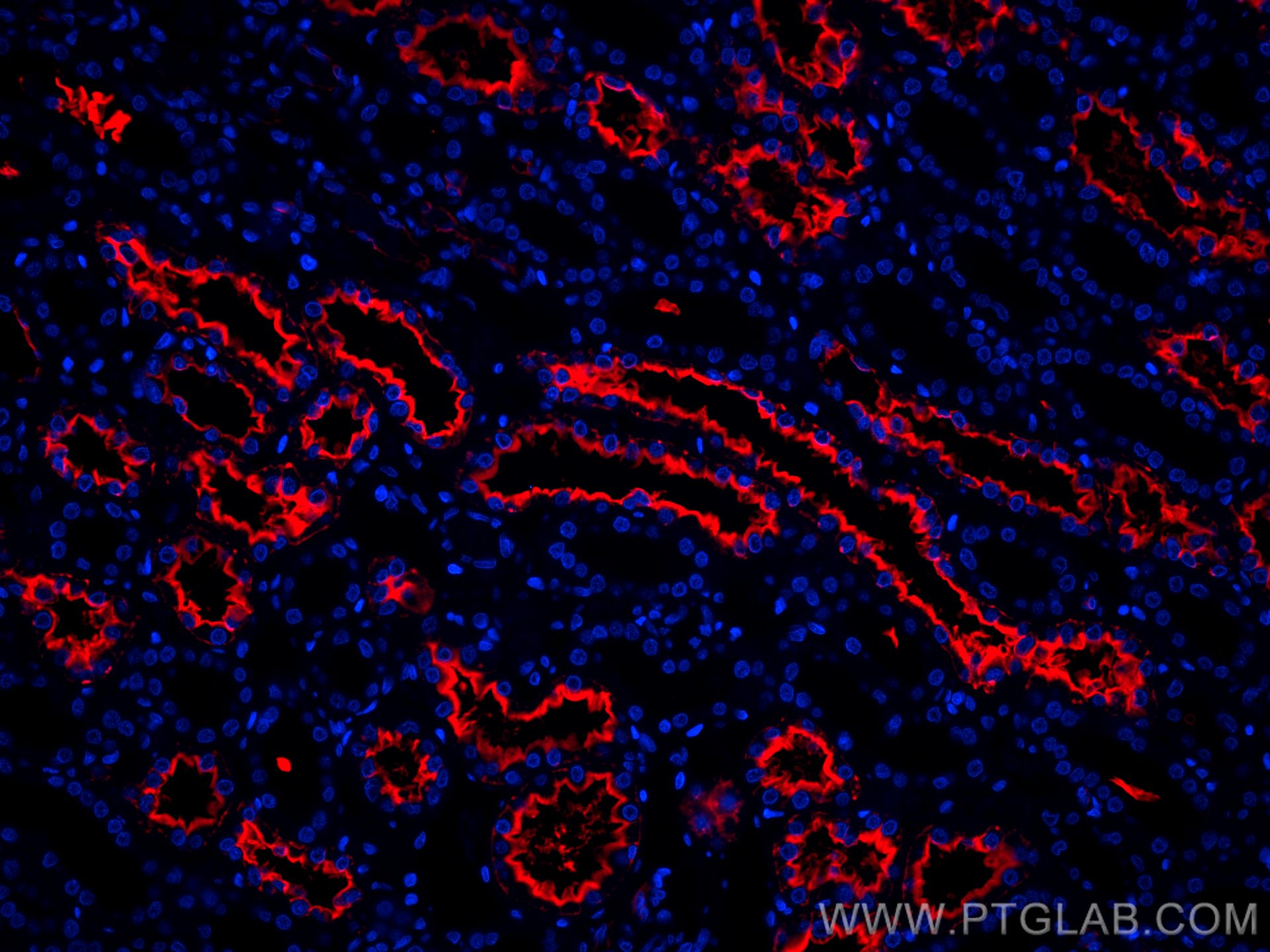 Immunofluorescence (IF) / fluorescent staining of human kidney tissue using CoraLite®594-conjugated AQP1 Monoclonal antibody (CL594-66805)