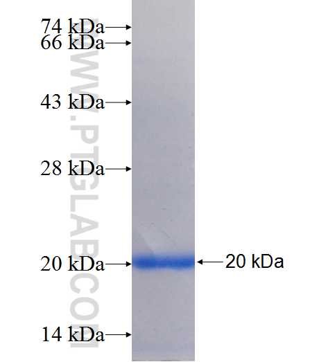 AQP10 fusion protein Ag25851 SDS-PAGE
