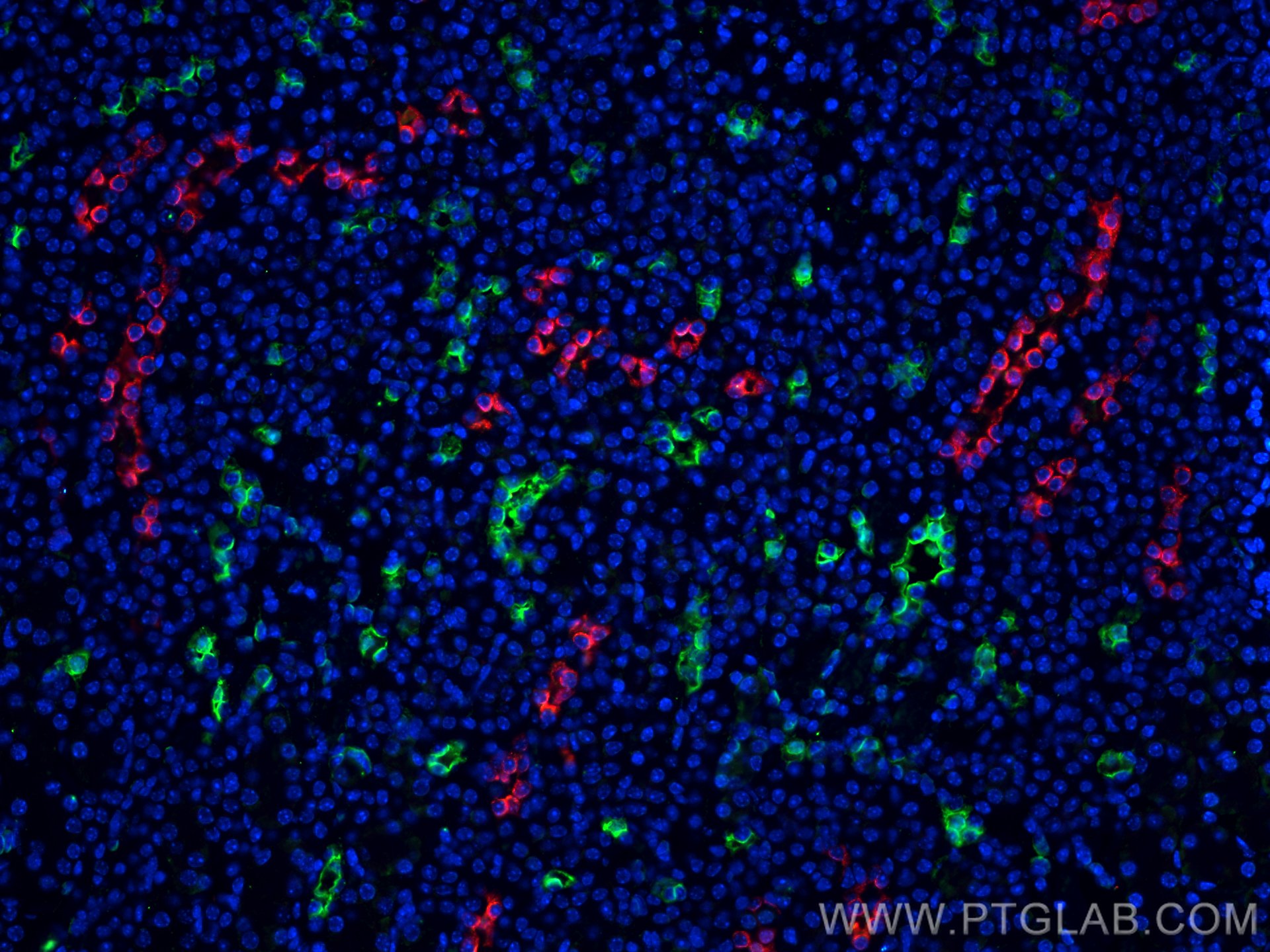 Immunofluorescence (IF) / fluorescent staining of mouse kidney tissue using AQP2 Polyclonal antibody (29386-1-AP)