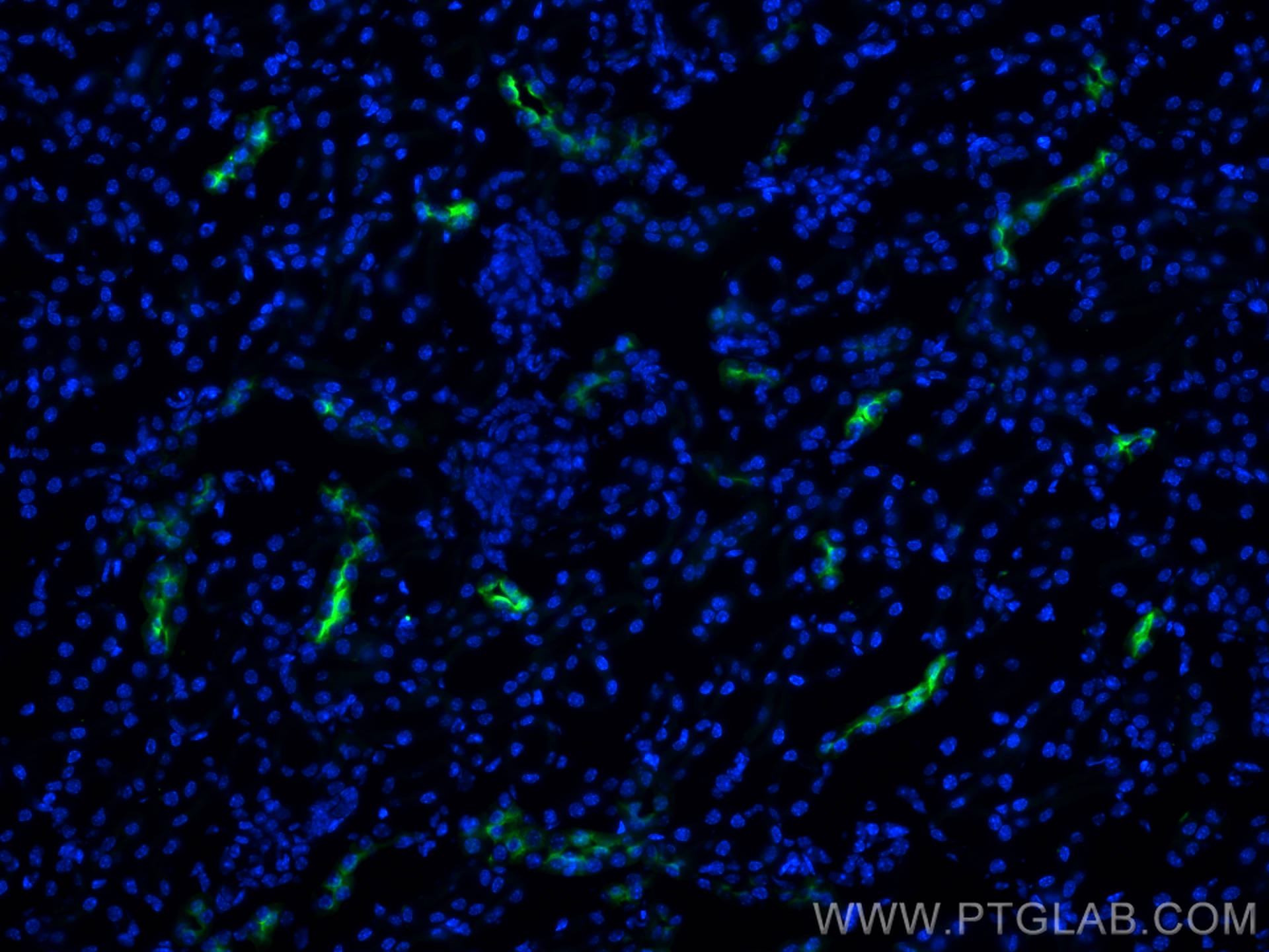 Immunofluorescence (IF) / fluorescent staining of mouse kidney tissue using AQP2 Polyclonal antibody (29386-1-AP)