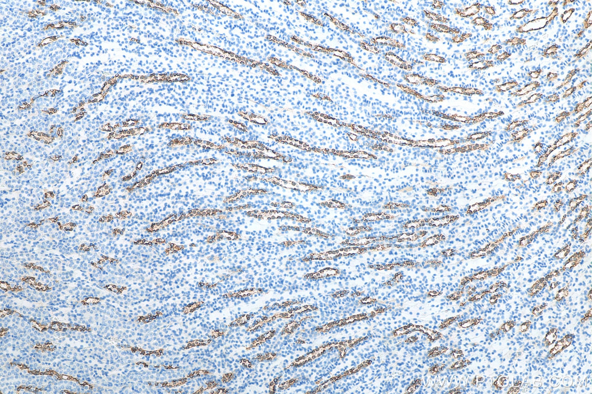 Immunohistochemistry (IHC) staining of mouse kidney tissue using AQP2 Polyclonal antibody (29386-1-AP)