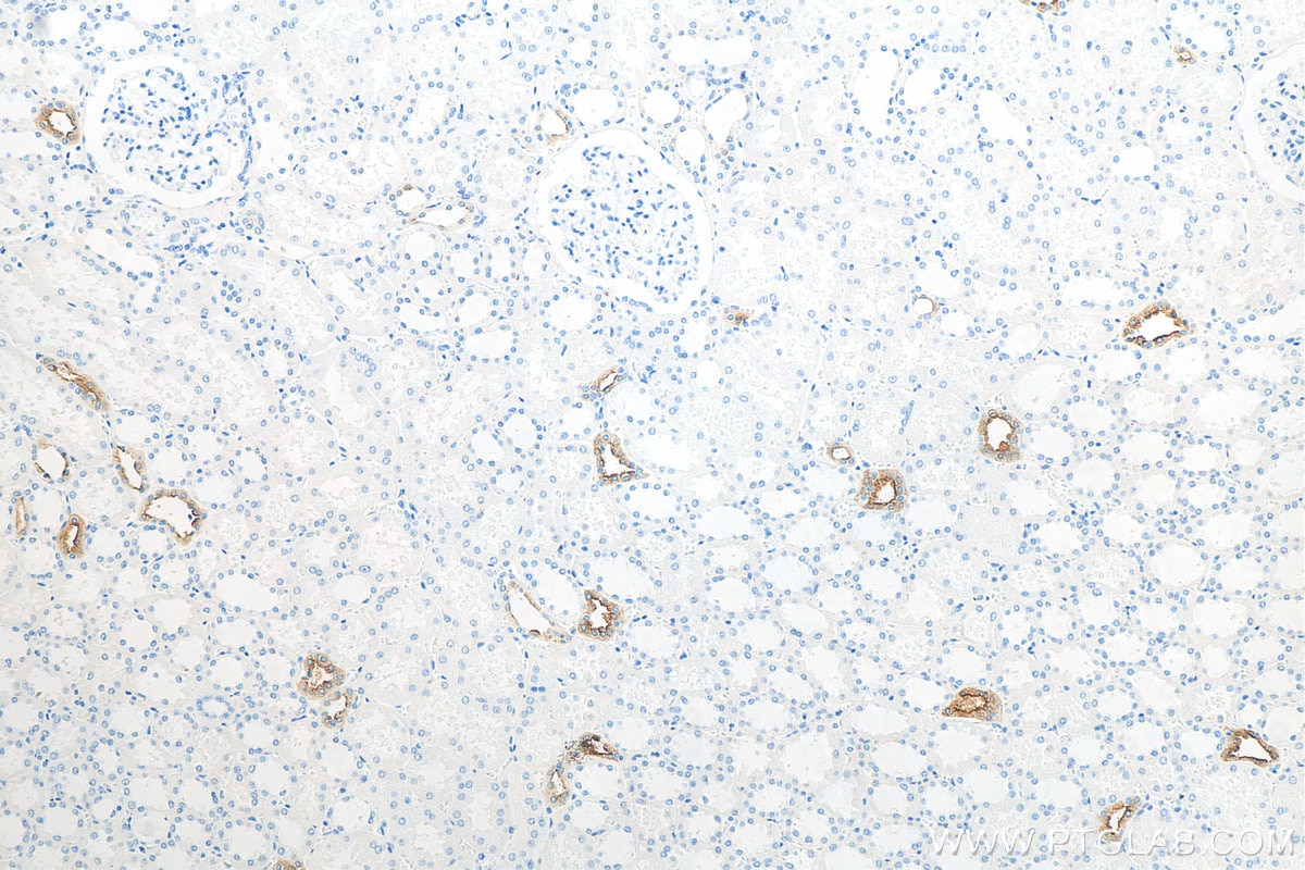 Immunohistochemistry (IHC) staining of human kidney tissue using AQP2 Polyclonal antibody (29386-1-AP)