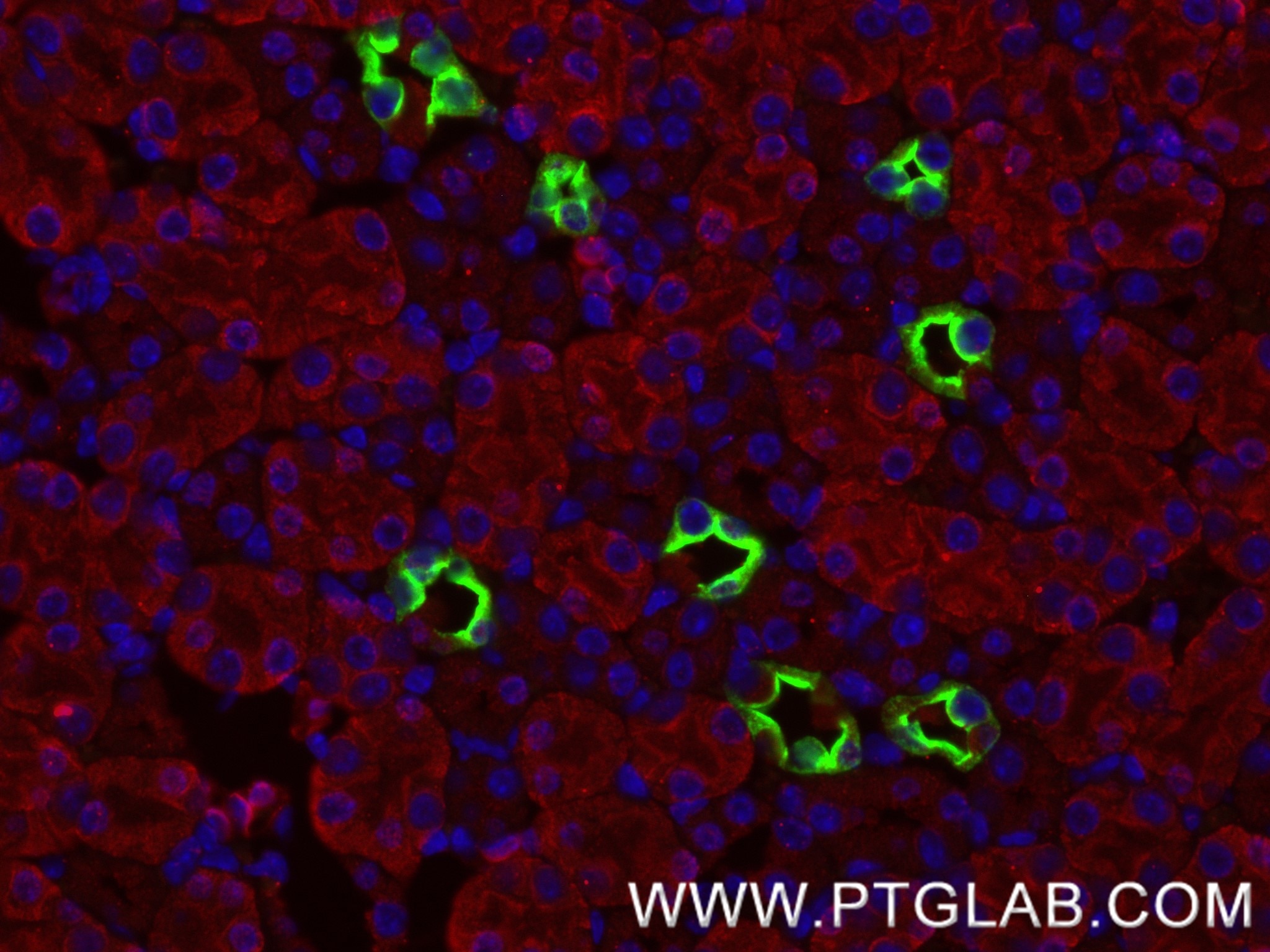 Immunofluorescence (IF) / fluorescent staining of mouse kidney tissue using AQP2 Recombinant monoclonal antibody (85402-1-RR)