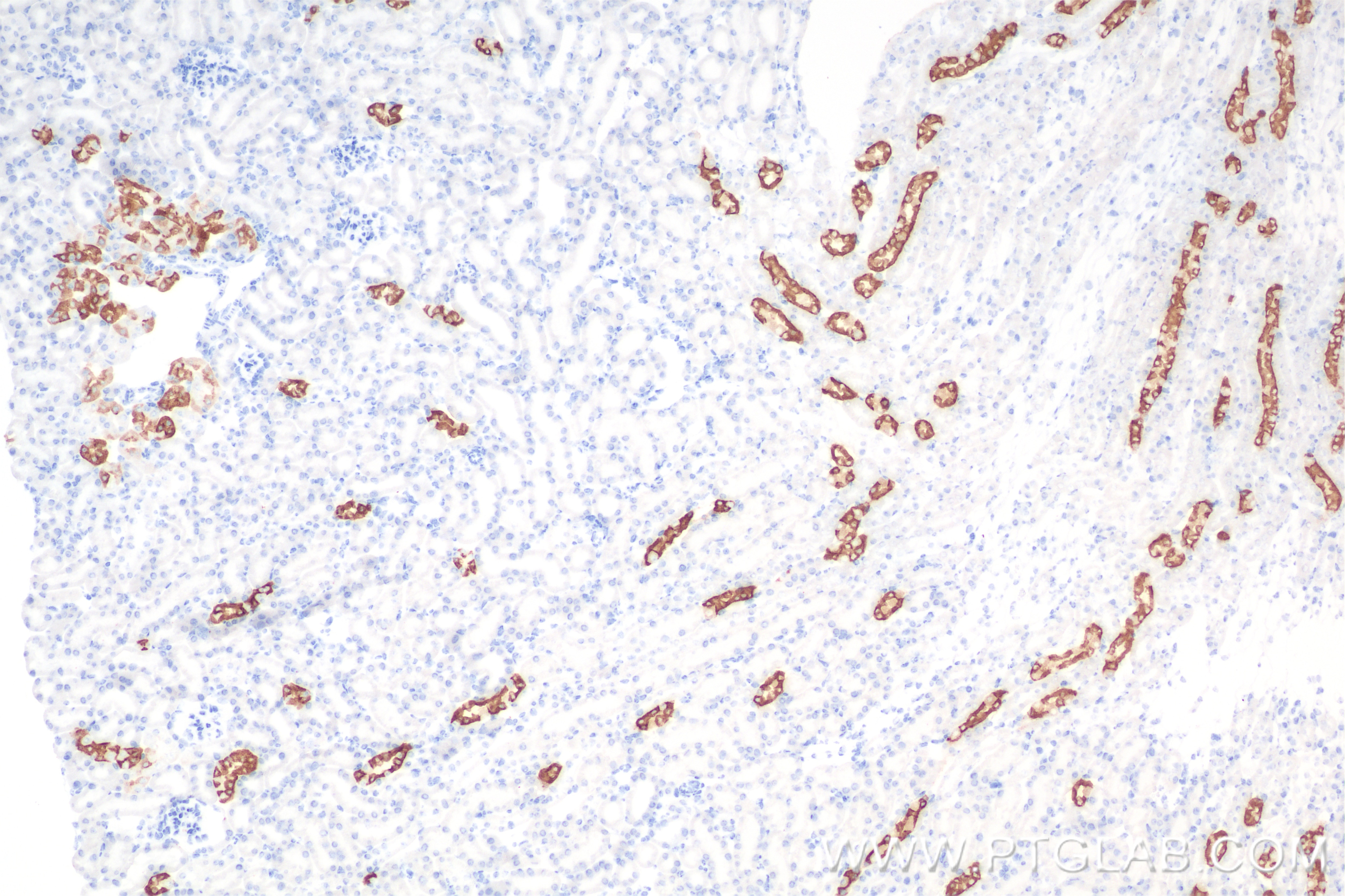 Immunohistochemistry (IHC) staining of mouse kidney tissue using AQP2 Recombinant antibody (85402-1-RR)
