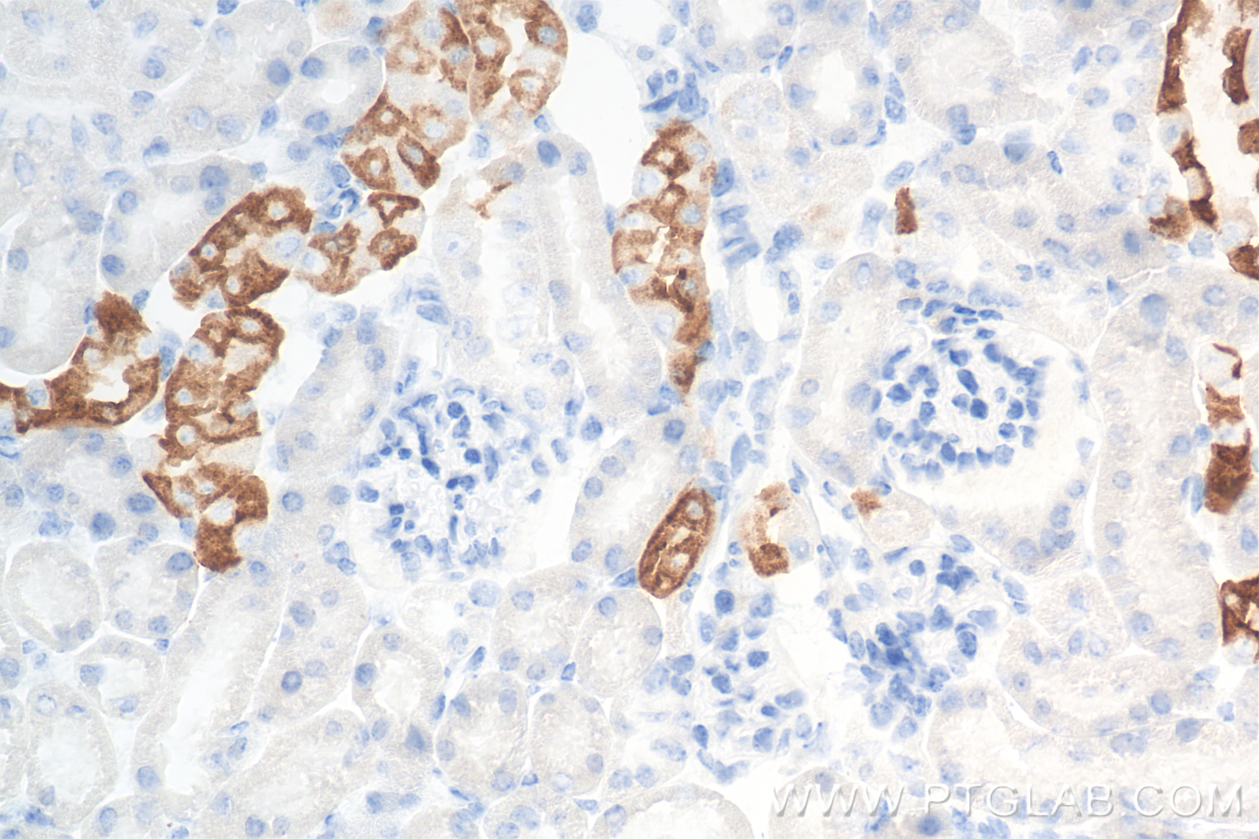 Immunohistochemistry (IHC) staining of mouse kidney tissue using AQP2 Recombinant antibody (85402-1-RR)