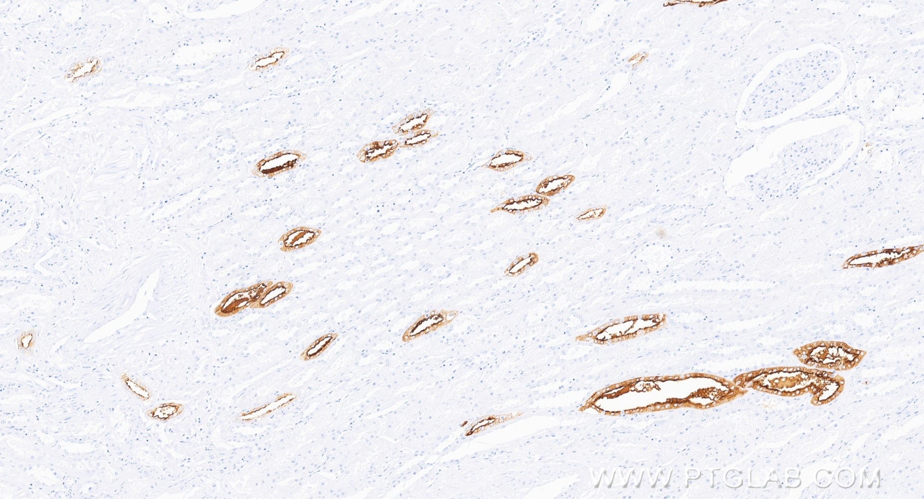 Immunohistochemistry (IHC) staining of human kidney tissue using AQP2 Recombinant monoclonal antibody (85402-1-RR)