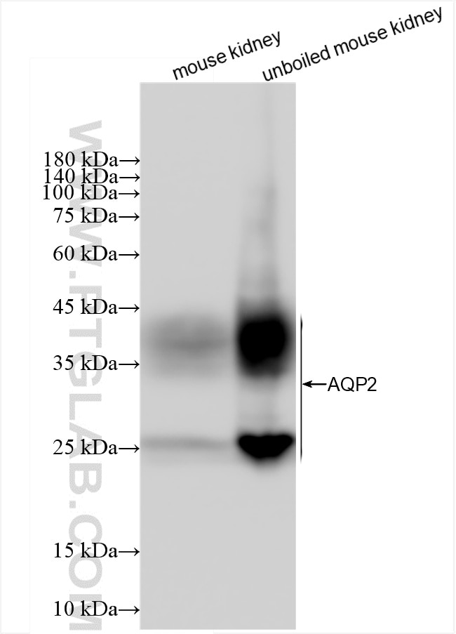 AQP2