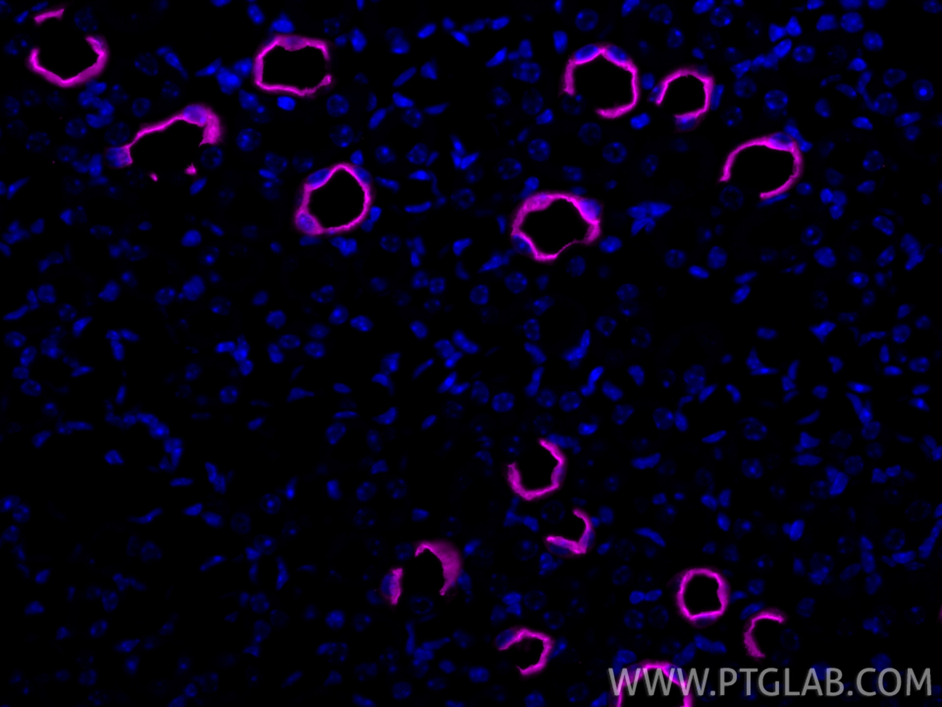 IF Staining of mouse kidney using CL647-85402 Immunofluorescence (IF) / fluorescent staining of mouse kidney tissue using CoraLite® Plus 647-conjugated AQP2 Recombinant mon (CL647-85402)