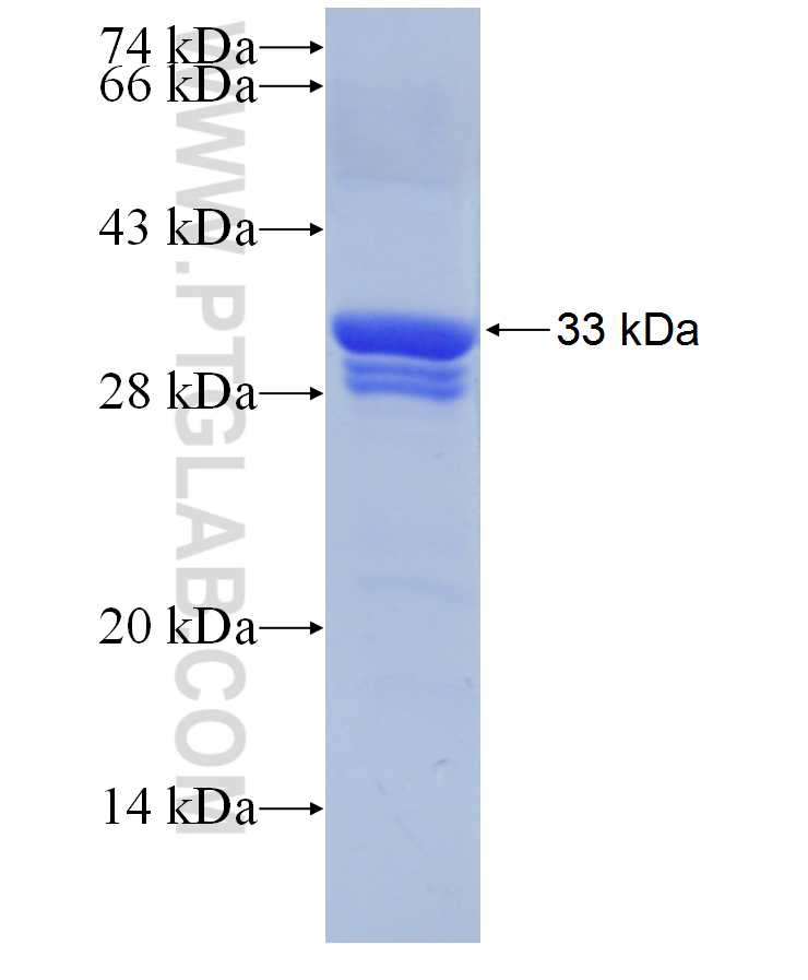 AQP2 fusion protein Ag29931 SDS-PAGE