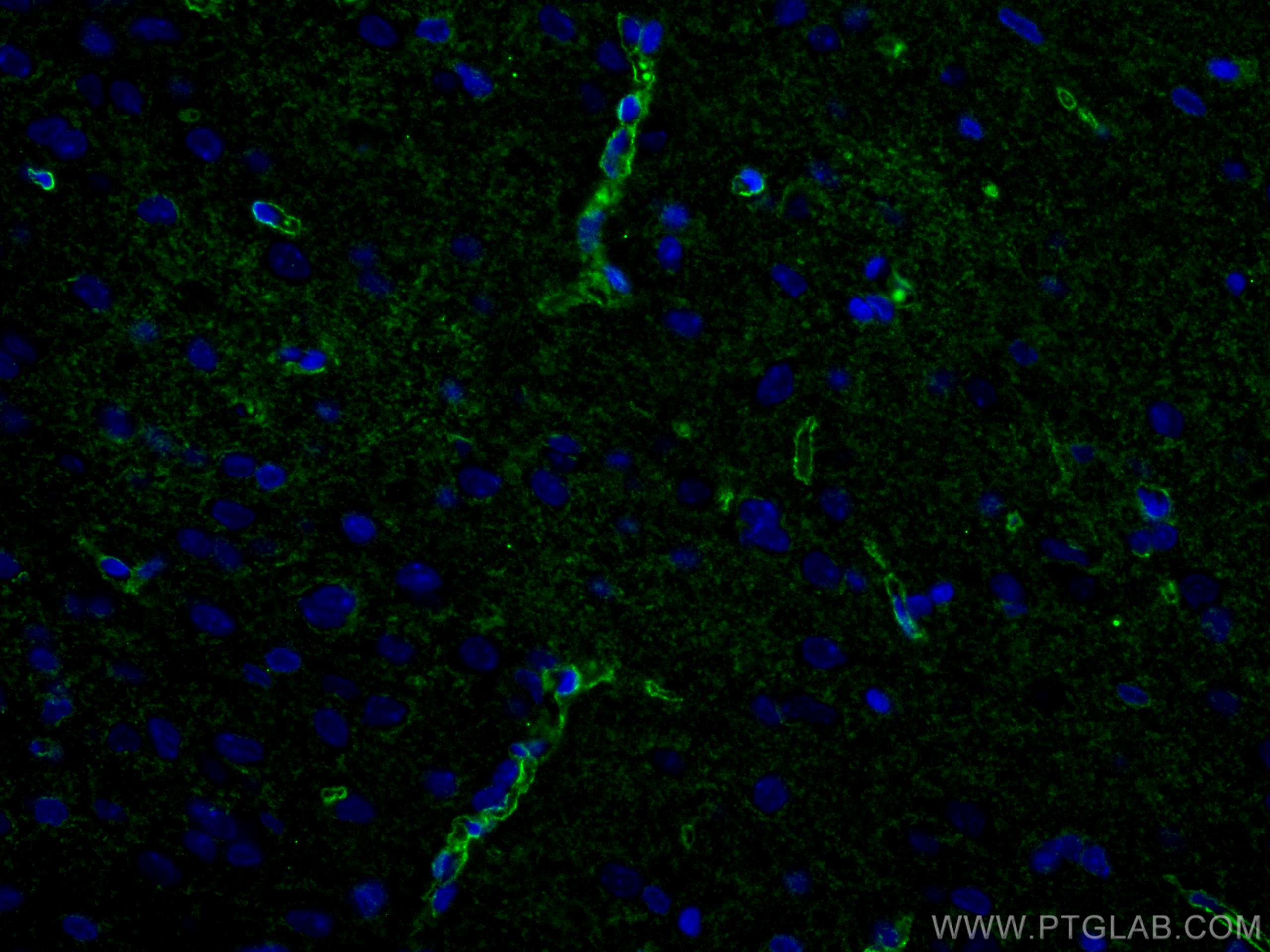 Immunofluorescence (IF) / fluorescent staining of rat brain tissue using Aquaporin 4 Polyclonal antibody (16473-1-AP)