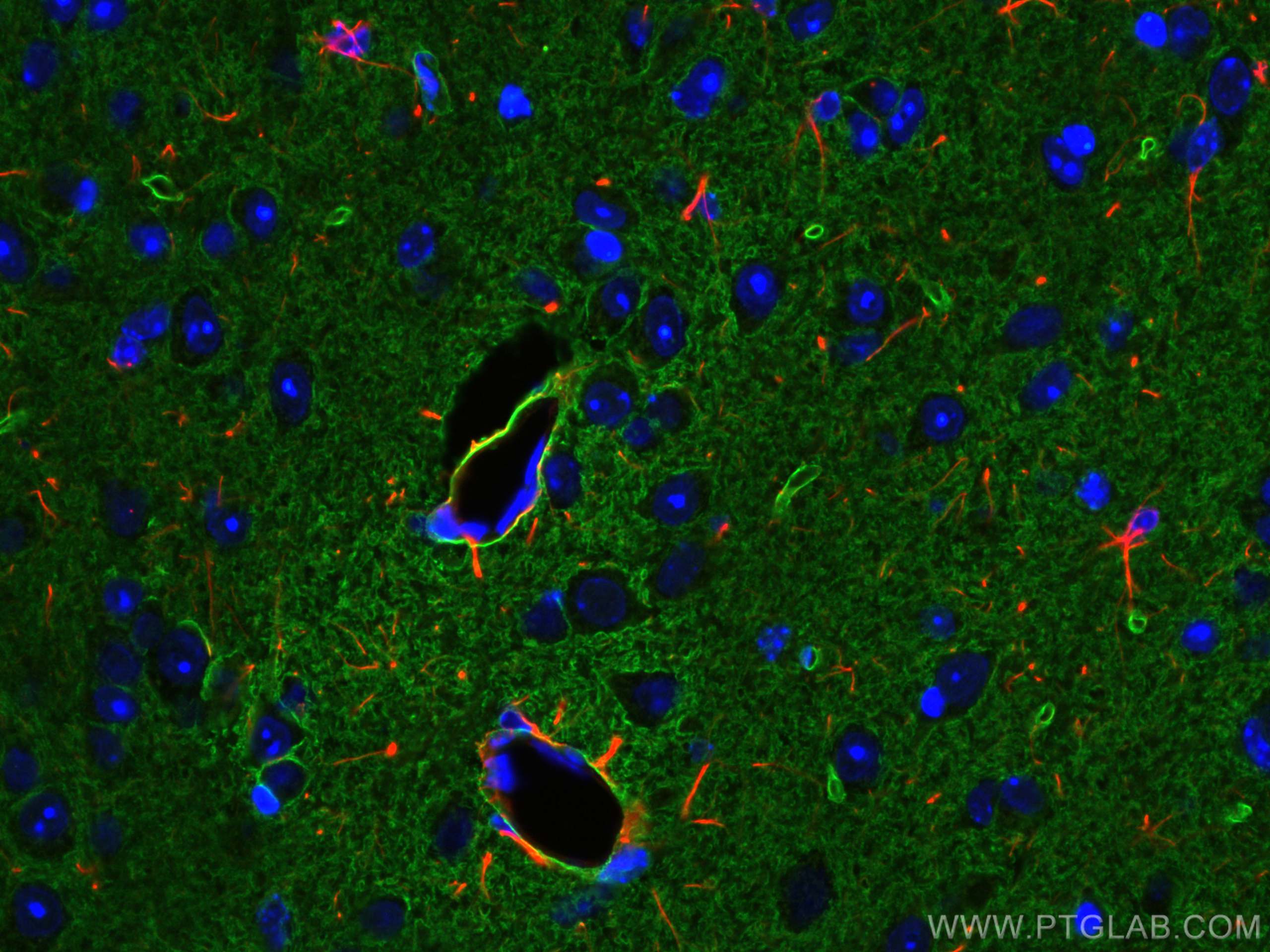 Immunofluorescence (IF) / fluorescent staining of mouse brain tissue using Aquaporin 4 Polyclonal antibody (16473-1-AP)