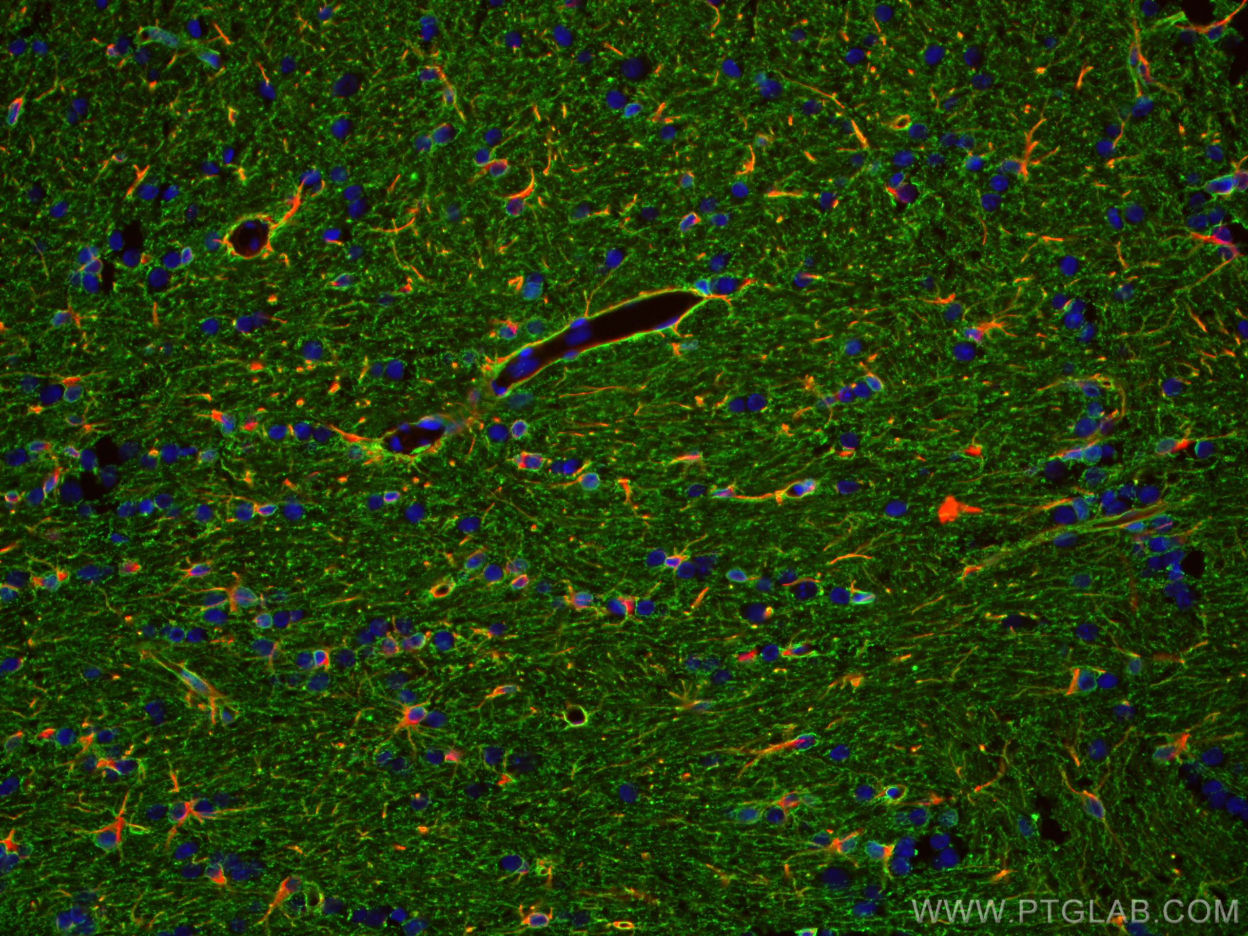Immunofluorescence (IF) / fluorescent staining of rat brain tissue using Aquaporin 4 Polyclonal antibody (16473-1-AP)