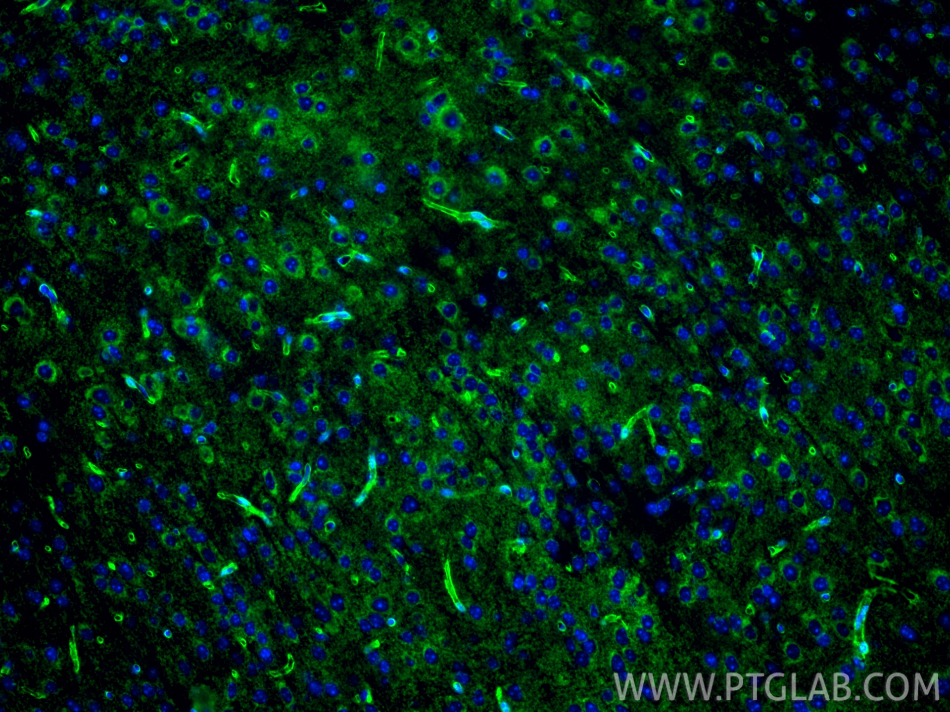 Immunofluorescence (IF) / fluorescent staining of mouse brain tissue using Aquaporin 4 Polyclonal antibody (16473-1-AP)
