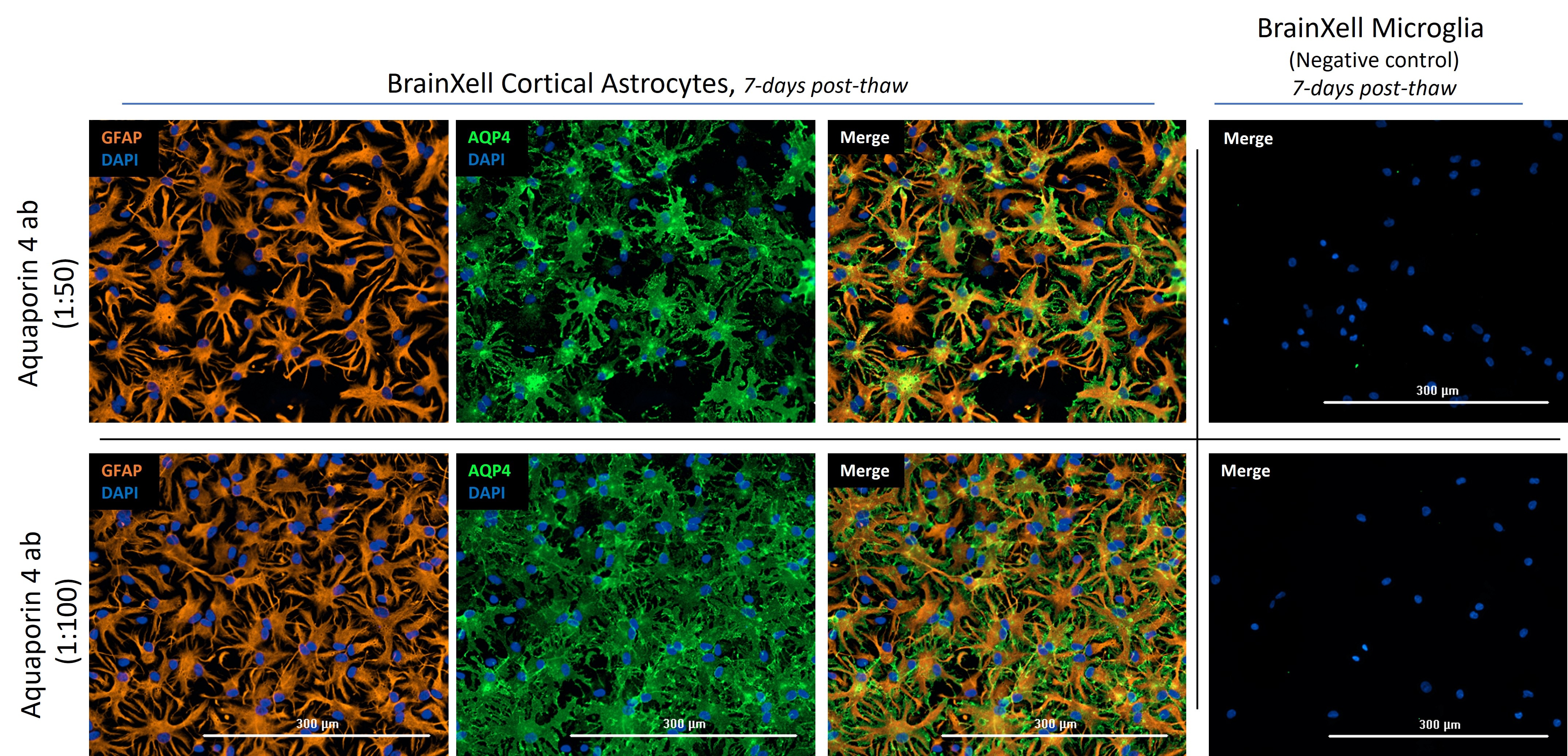 Immunofluorescence (IF) / fluorescent staining of hiPSC-derived cortical astrocytes using Aquaporin 4 Polyclonal antibody (16473-1-AP)