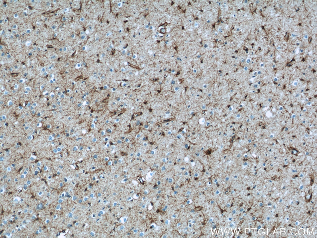 Immunohistochemistry (IHC) staining of human brain tissue using Aquaporin 4 Polyclonal antibody (16473-1-AP)