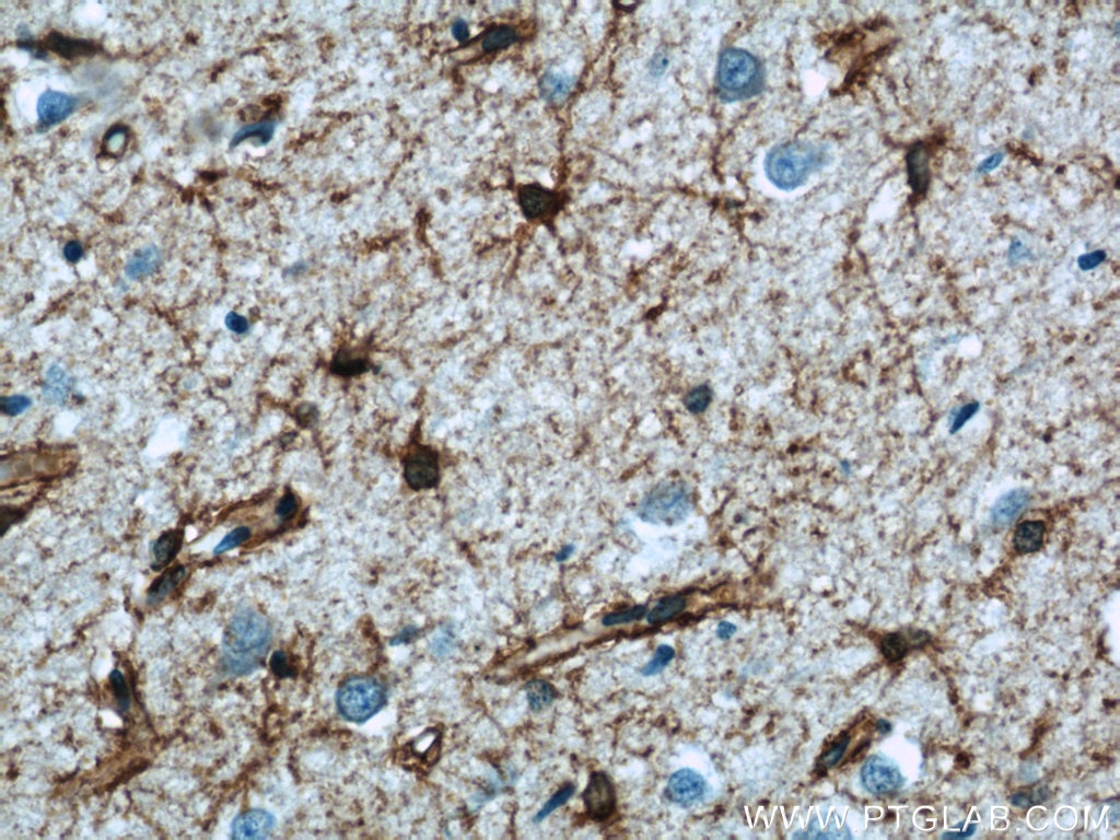 Immunohistochemistry (IHC) staining of human brain tissue using Aquaporin 4 Polyclonal antibody (16473-1-AP)