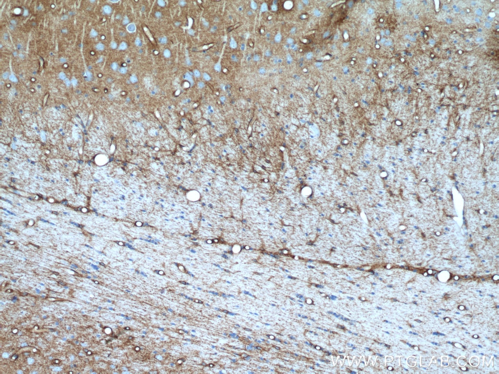 Immunohistochemistry (IHC) staining of rat brain tissue using Aquaporin 4 Polyclonal antibody (16473-1-AP)