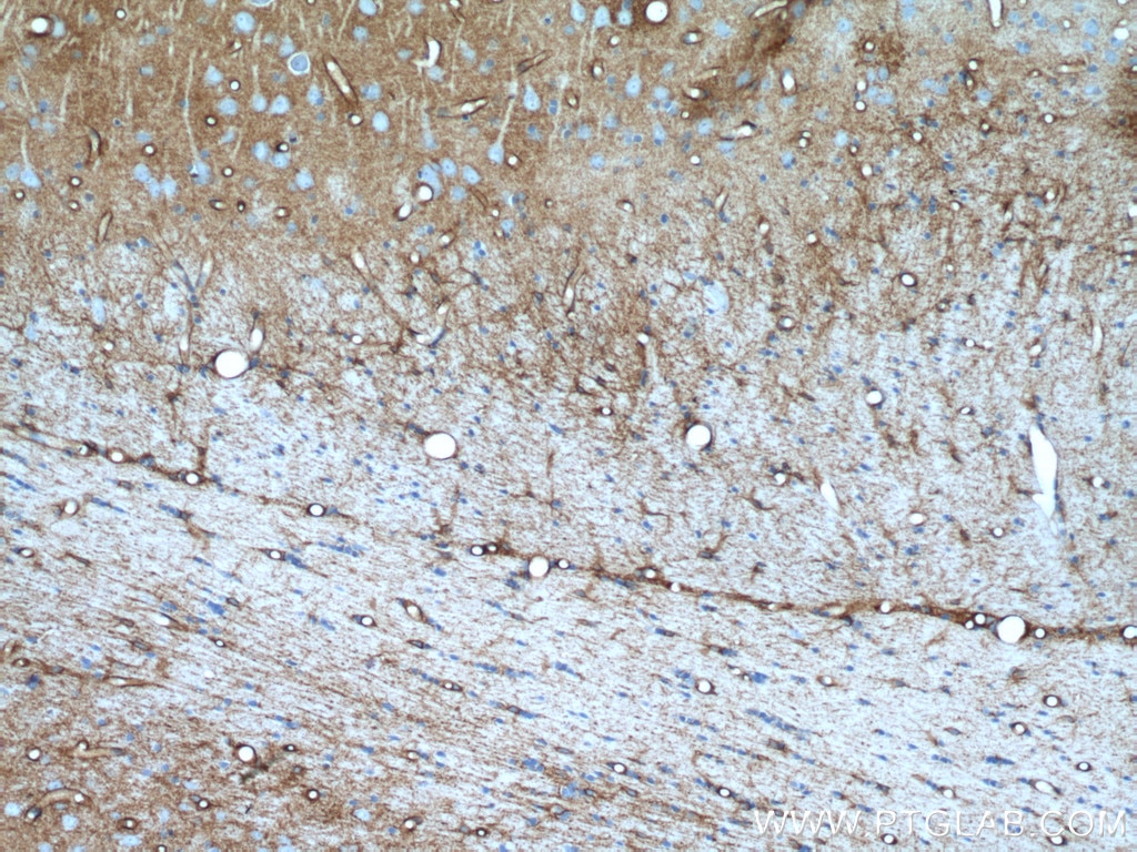 IHC staining of rat brain using 16473-1-AP