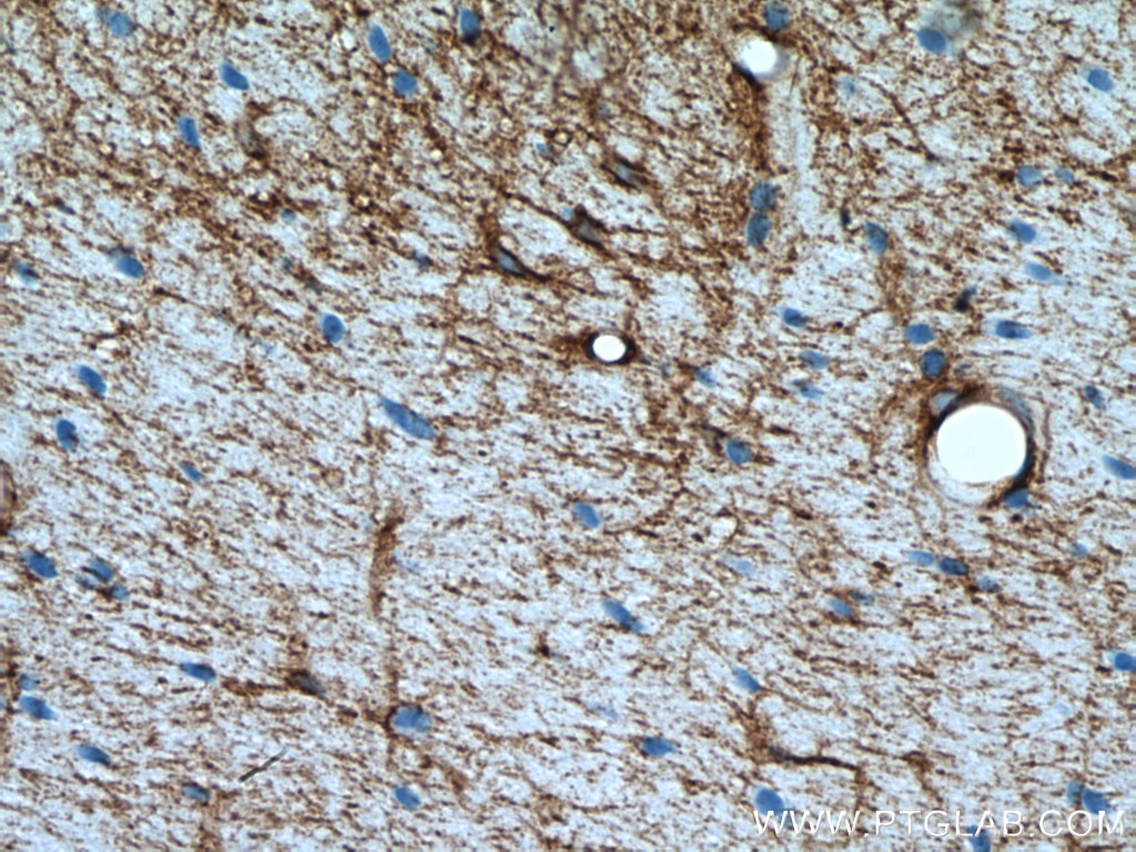 Immunohistochemistry (IHC) staining of rat brain tissue using Aquaporin 4 Polyclonal antibody (16473-1-AP)
