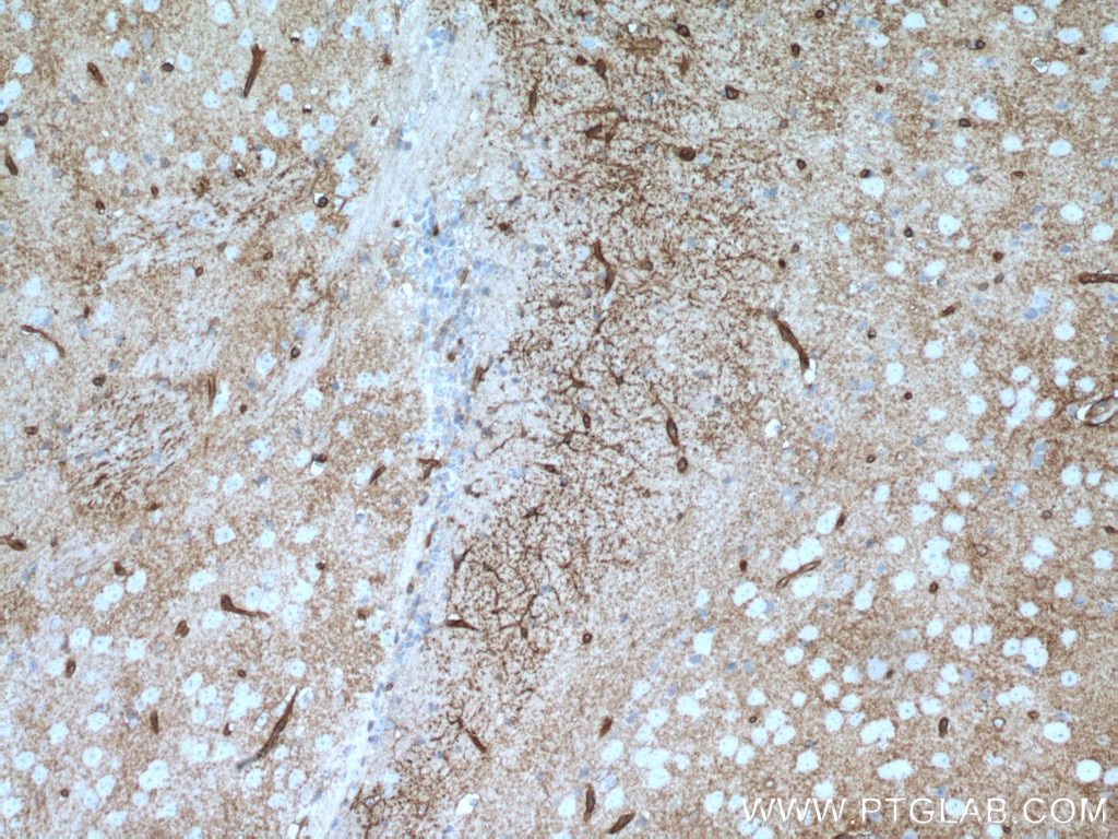 Immunohistochemistry (IHC) staining of mouse brain tissue using Aquaporin 4 Polyclonal antibody (16473-1-AP)