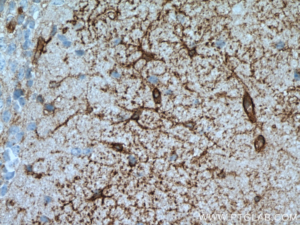 Immunohistochemistry (IHC) staining of mouse brain tissue using Aquaporin 4 Polyclonal antibody (16473-1-AP)