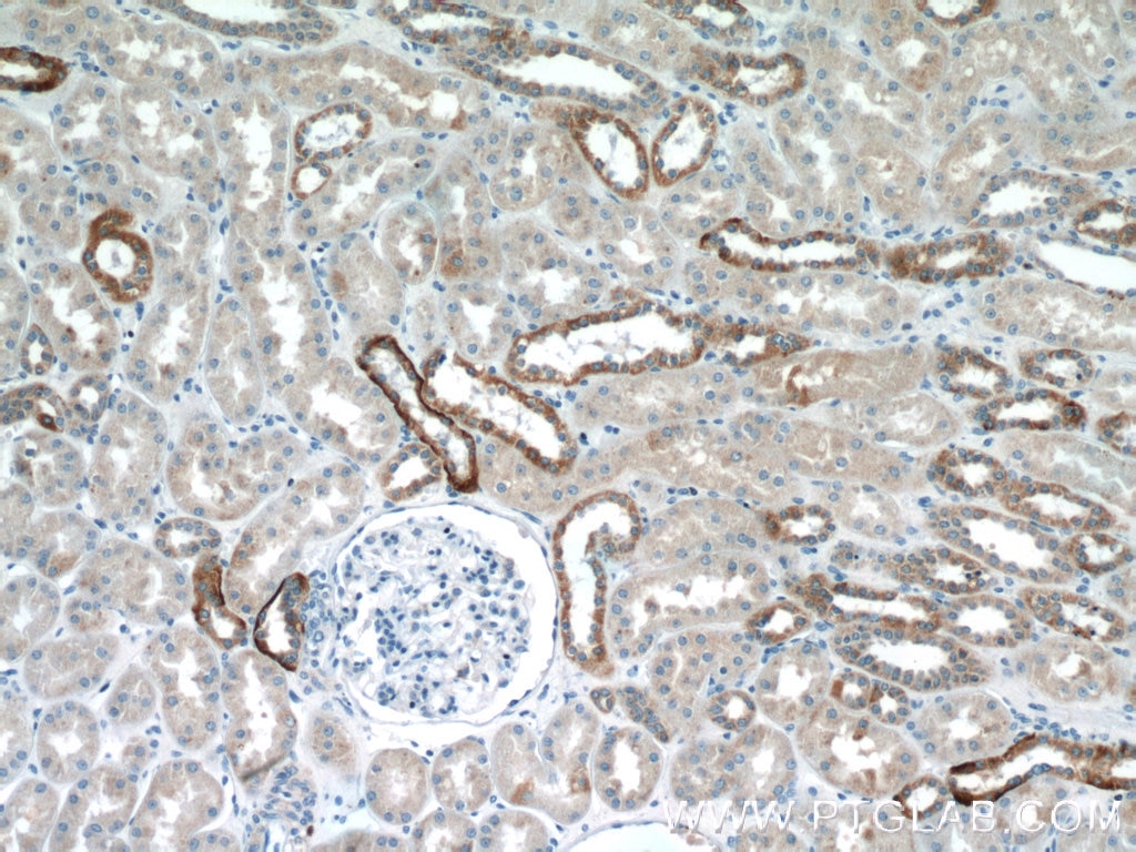Immunohistochemistry (IHC) staining of human kidney tissue using Aquaporin 4 Polyclonal antibody (16473-1-AP)