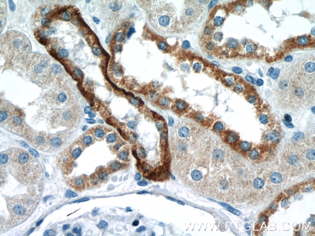 Immunohistochemistry (IHC) staining of human kidney tissue using Aquaporin 4 Polyclonal antibody (16473-1-AP)