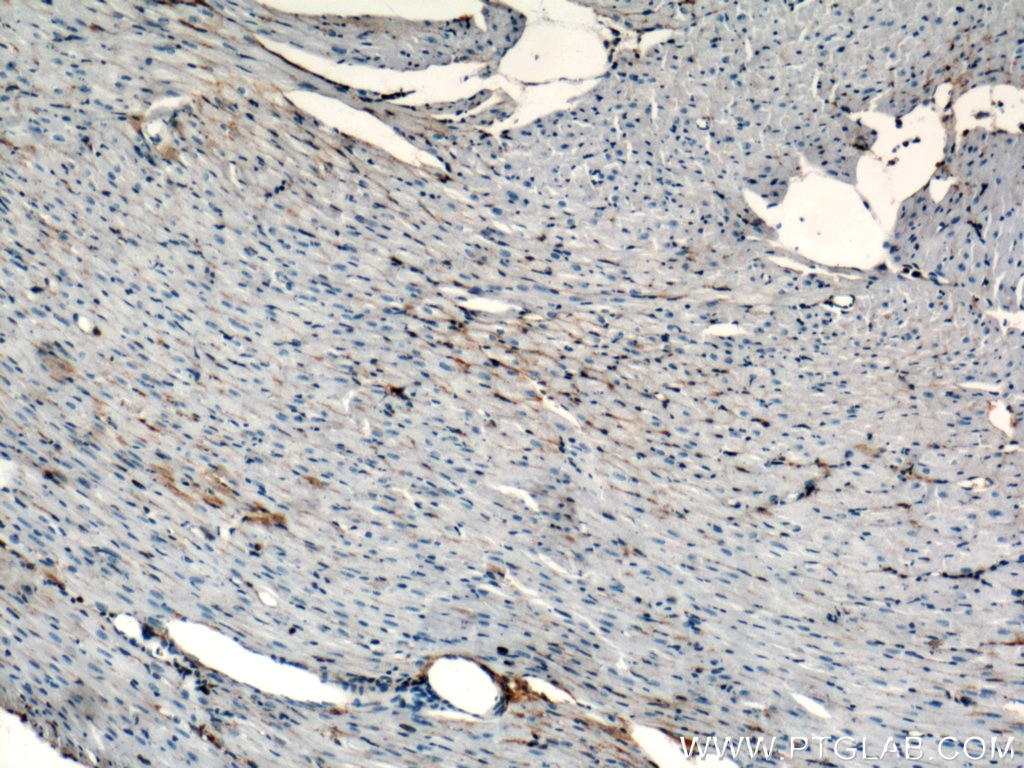 Immunohistochemistry (IHC) staining of mouse heart tissue using Aquaporin 4 Polyclonal antibody (16473-1-AP)