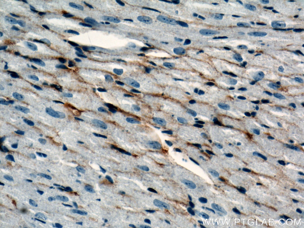 Immunohistochemistry (IHC) staining of mouse heart tissue using Aquaporin 4 Polyclonal antibody (16473-1-AP)