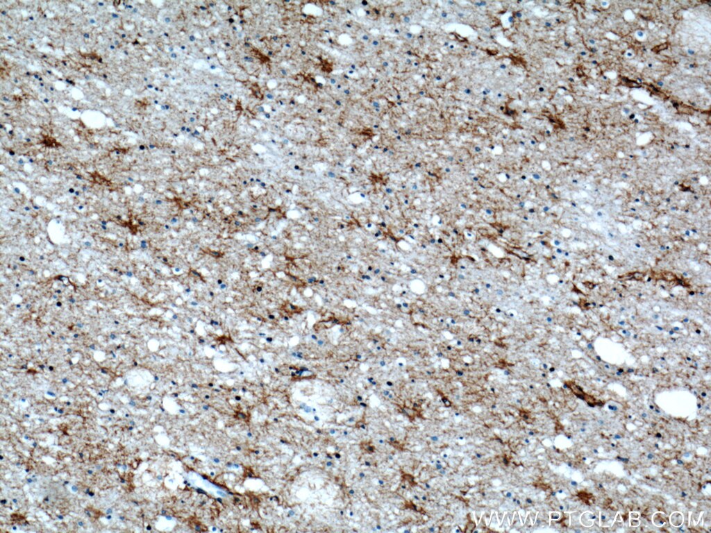 Aquaporin 4 Polyclonal antibody