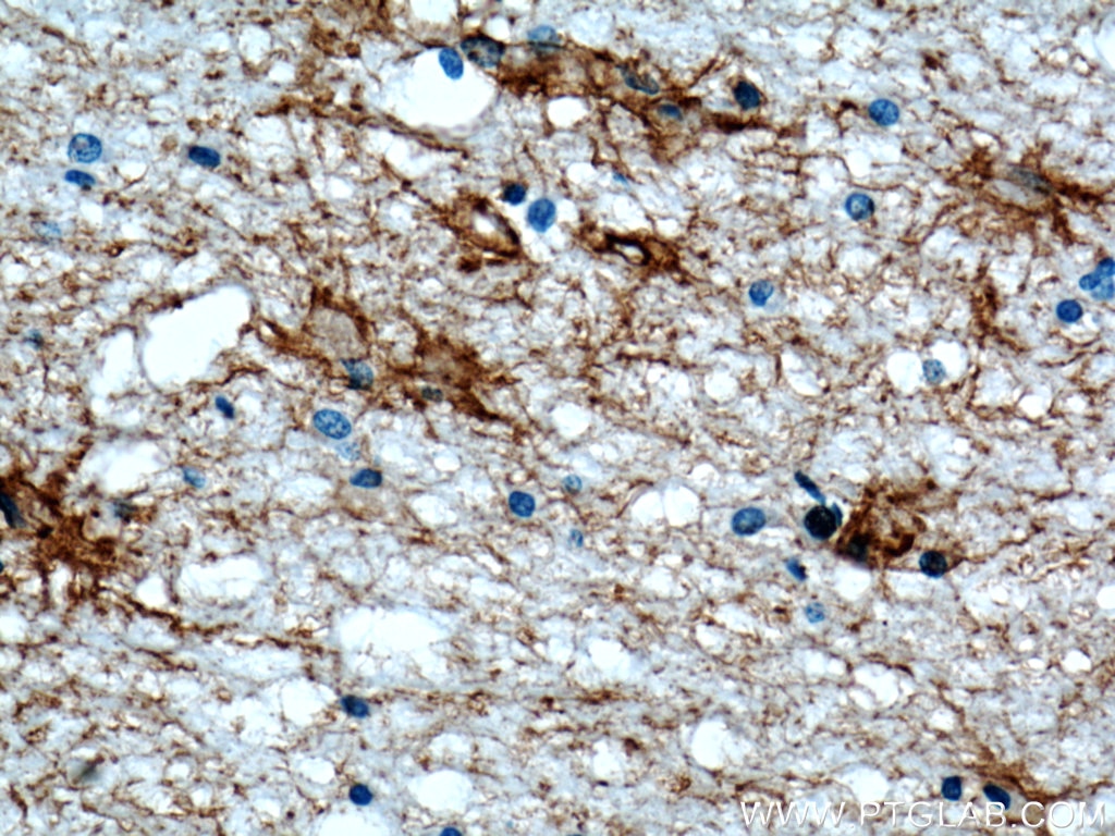 Aquaporin 4 Polyclonal antibody