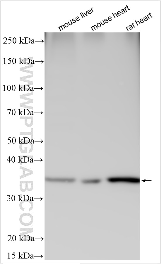 Western Blot (WB) analysis of various lysates using Aquaporin 4 Polyclonal antibody (16473-1-AP)