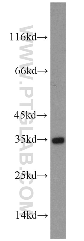 Western Blot (WB) analysis of SKOV-3 cells using Aquaporin 4 Polyclonal antibody (16473-1-AP)