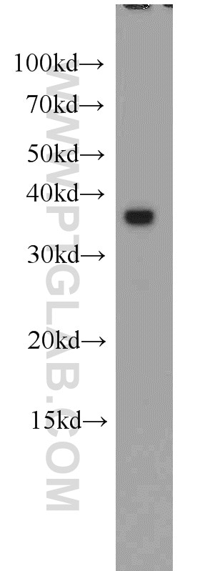 WB analysis of mouse kidney using 16473-1-AP