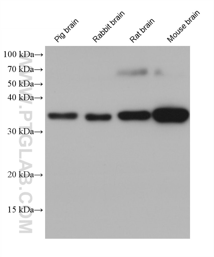 Western Blot (WB) analysis of various lysates using AQP4 Monoclonal antibody (68448-1-Ig)