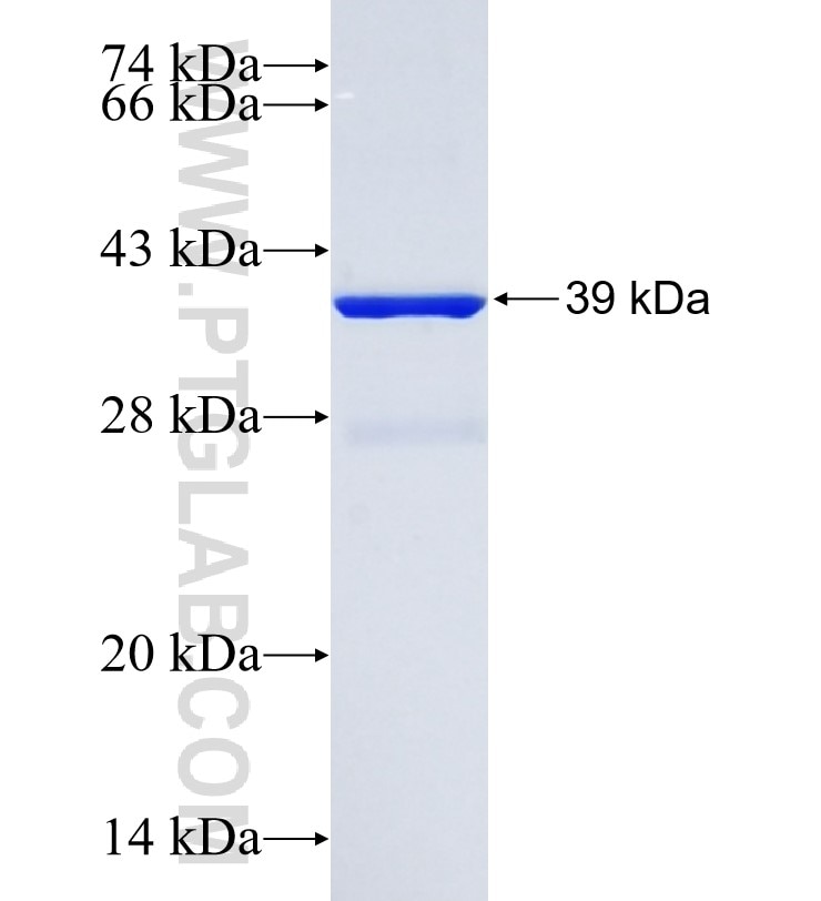 AQP4 fusion protein Ag9561 SDS-PAGE