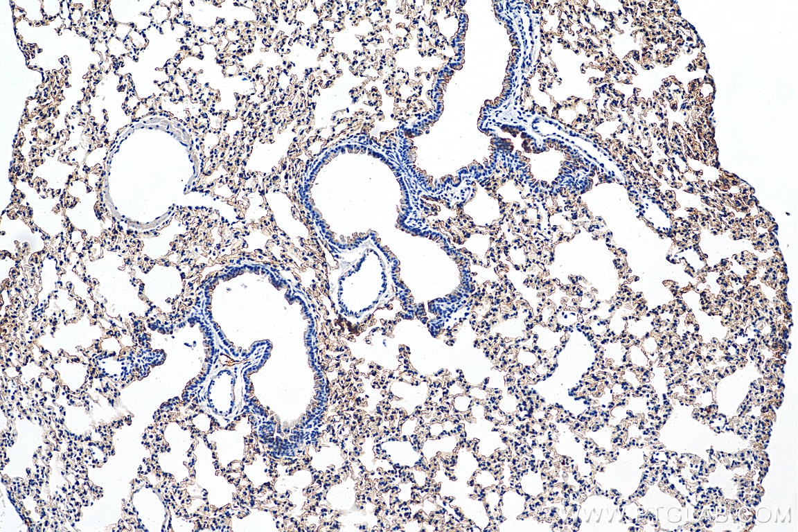 Immunohistochemistry (IHC) staining of mouse lung tissue using AQP5 Polyclonal antibody (20334-1-AP)