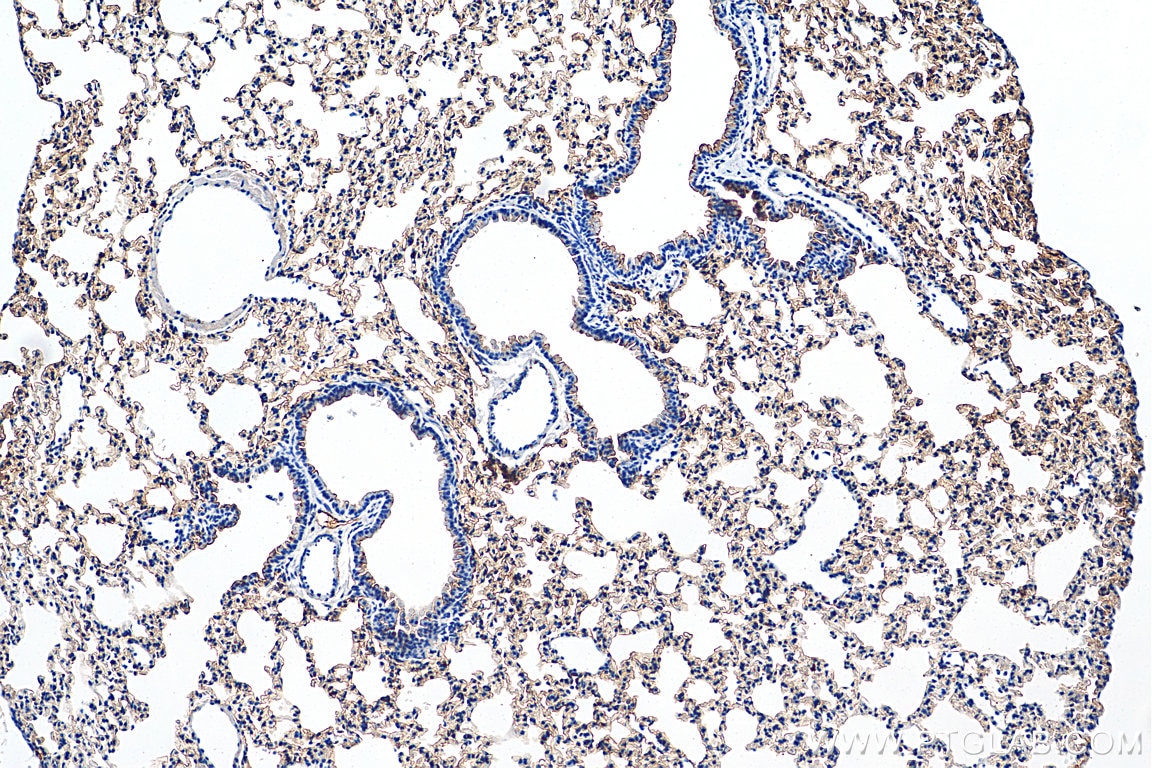 IHC staining of mouse lung using 20334-1-AP