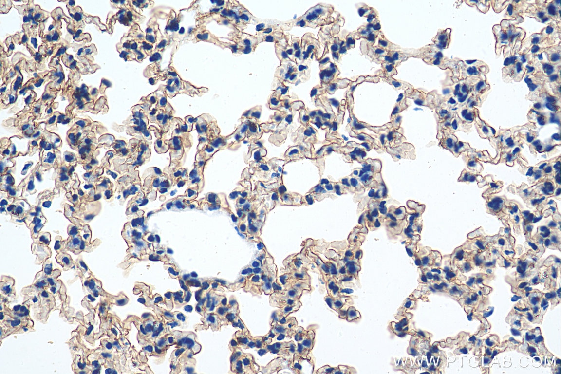 IHC staining of mouse lung using 20334-1-AP