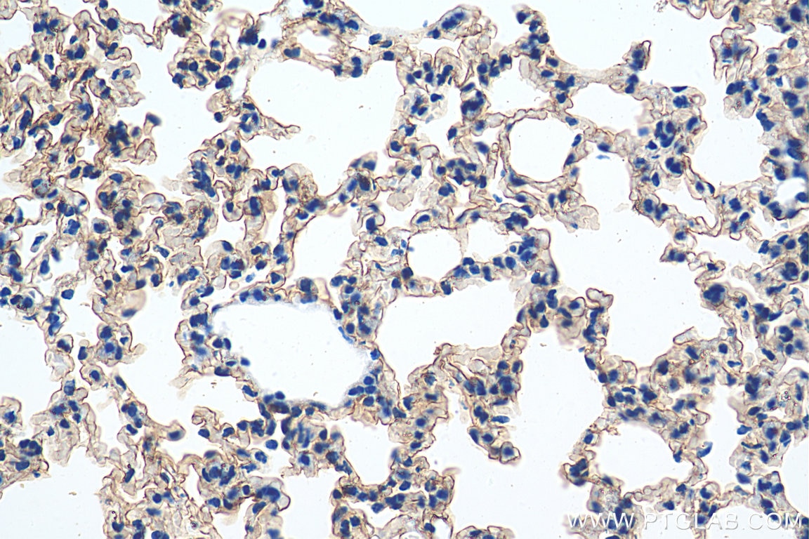 Immunohistochemistry (IHC) staining of mouse lung tissue using AQP5 Polyclonal antibody (20334-1-AP)