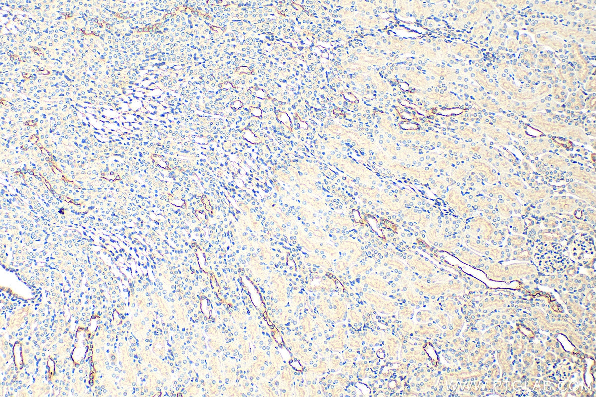 Immunohistochemistry (IHC) staining of mouse kidney tissue using AQP5 Polyclonal antibody (20334-1-AP)